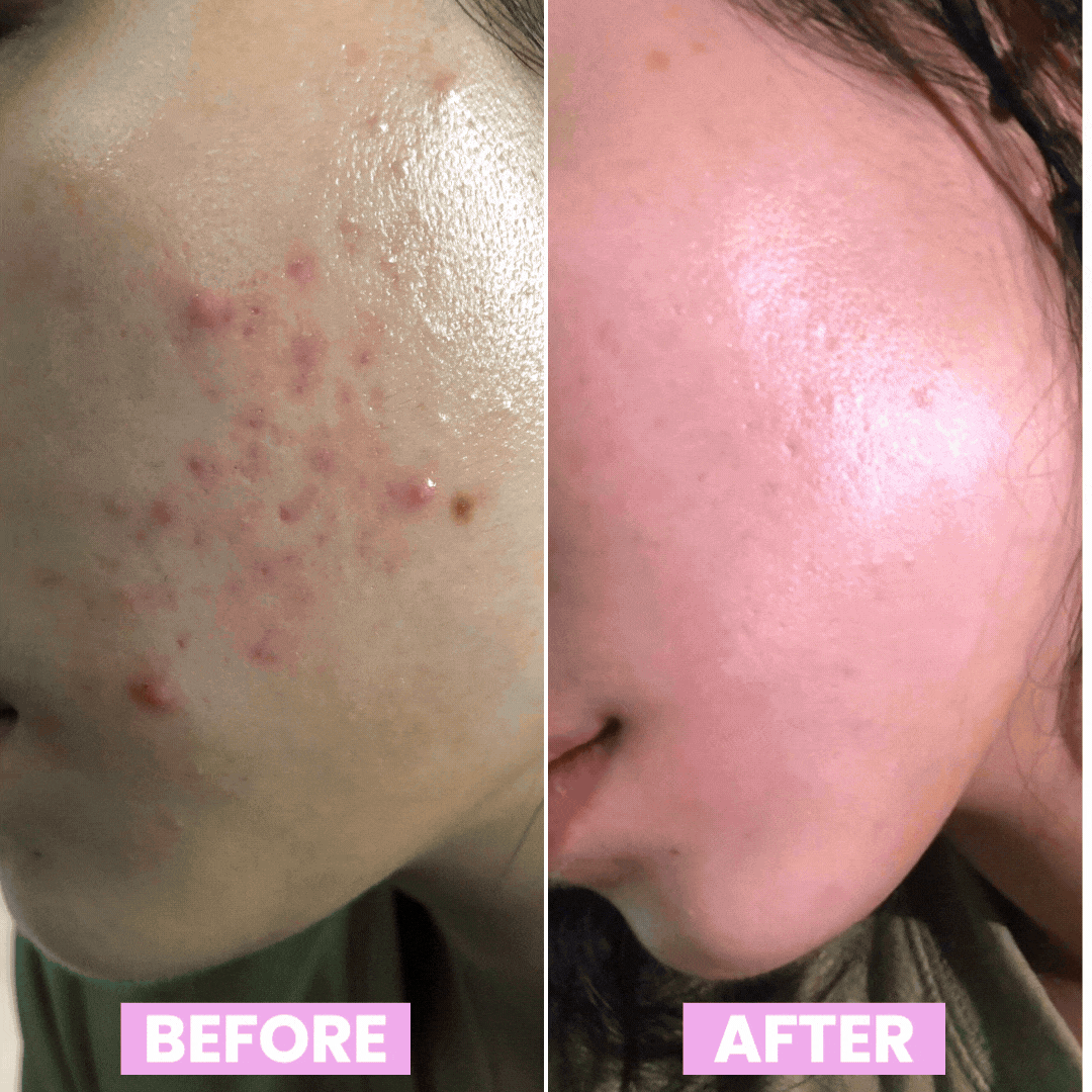 Sérum ultra hydratant à l'acide hyaluronique