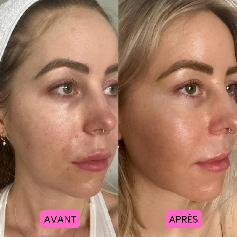 Before/After