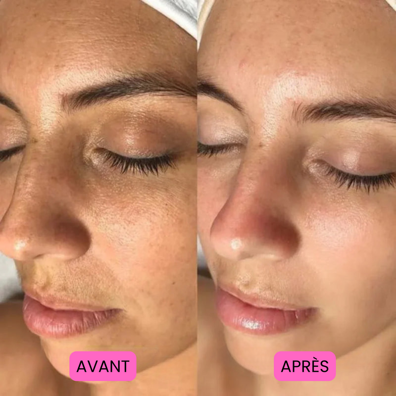 Before/After