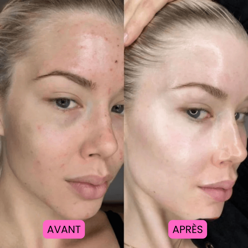Before/After