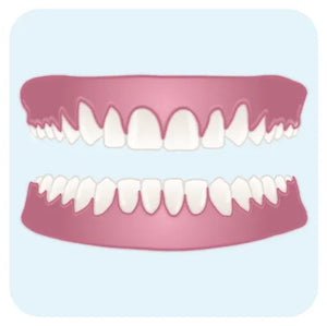 Dents courtes