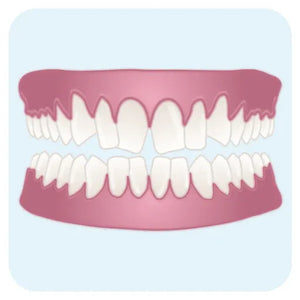Dents tordues